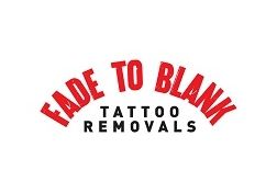 Tattoo Removal Leichhardt